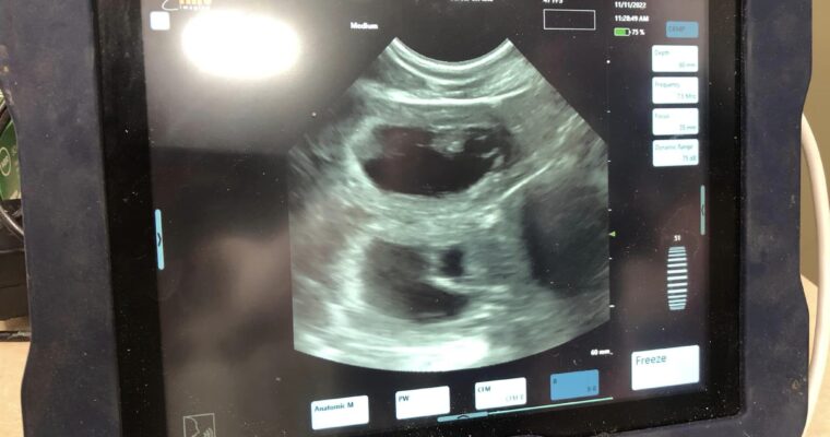 Stormy/Gunner Ultrasound Confirmation